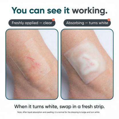 Hot-Spot Hydrocolloid Tape